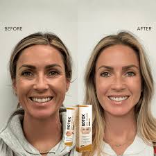 OUHOE - Bee Venom Botox Wrinkle Cream