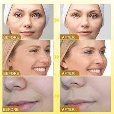 OUHOE - Bee Venom Botox Wrinkle Cream