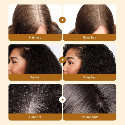 Batana Hair Oil (SAUVASINE) – 100% Scalp-Safe Hair Growth Oil