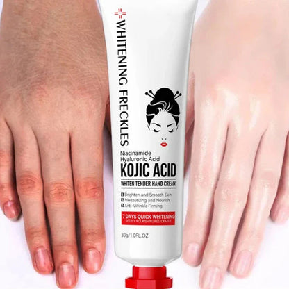 Sadoer – Kojic Acid Hand Cream (30g)
